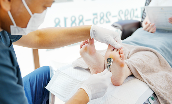 クレドで表面を削る