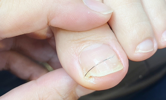 クレドで表面を削る